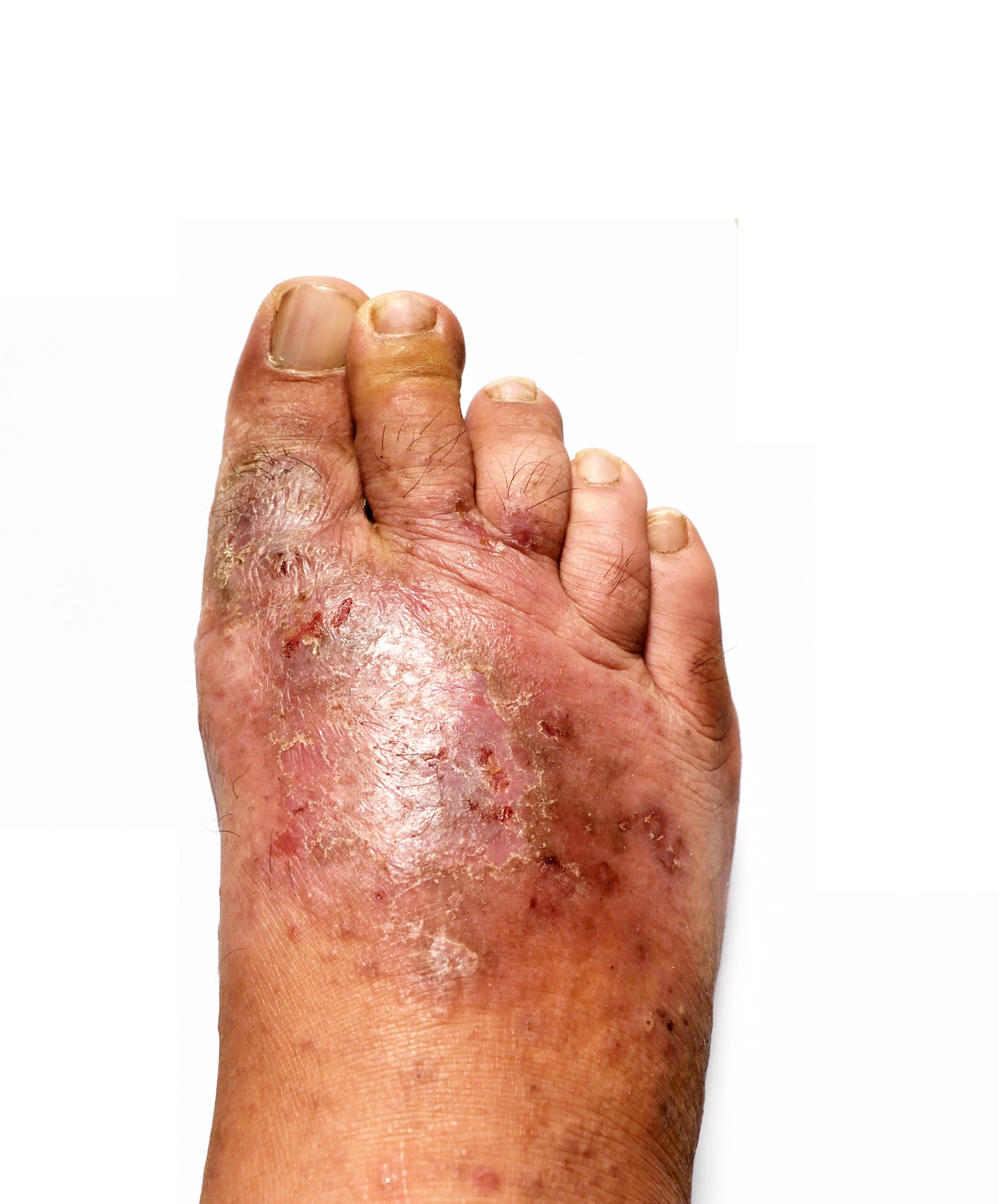 Dermatologia
